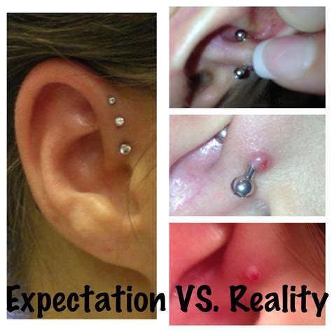 Body Piercing Infections